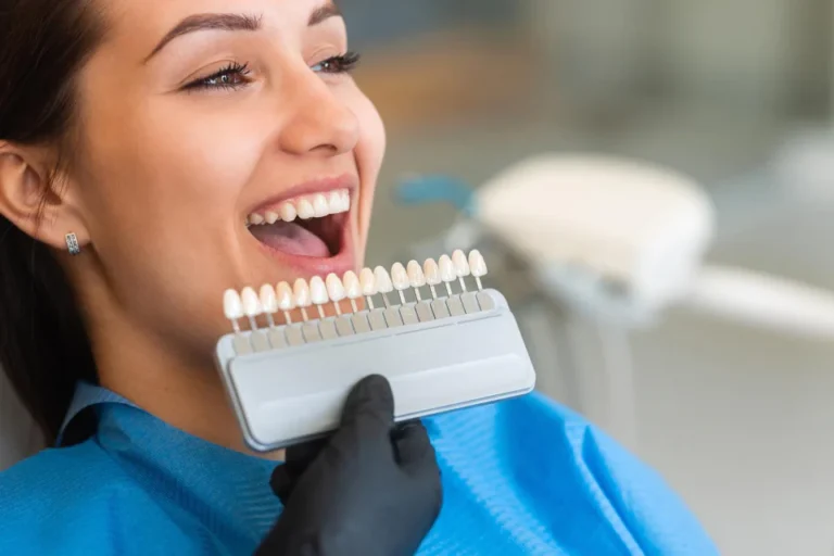 Teeth whitening in Tampa, FL at Solace Dental of Tampa